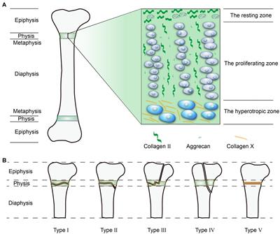 Frontiers Enlightenment of Growth Plate Regeneration Based on